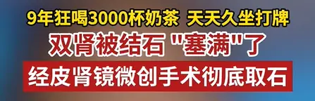 贪喝奶茶埋下健康隐患！女子九年三千杯引发肾脏结石