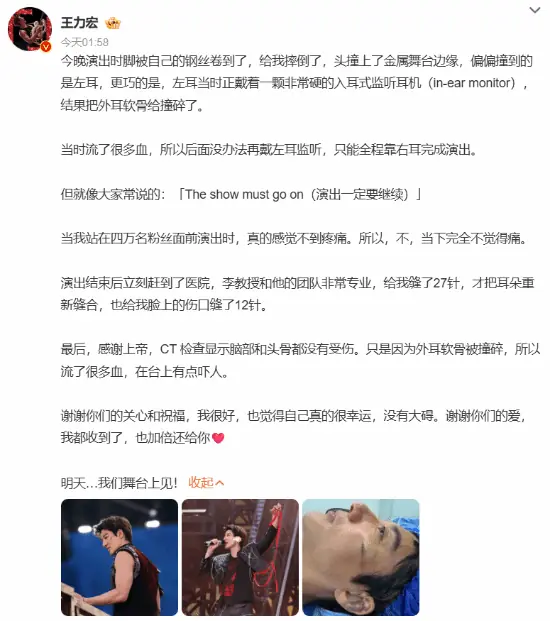太敬业！王力宏外耳软骨撞碎缝了39针：明日仍上台