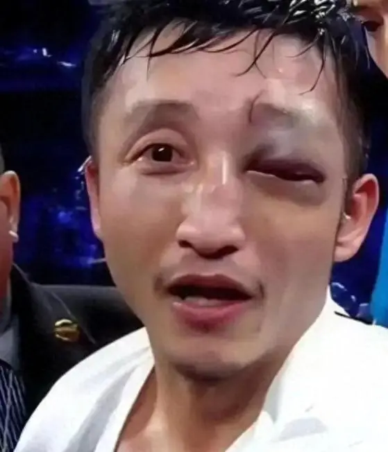 两亿亏损不过是表面现象,冉莹颖再度发声透露实情,揭开了邹市明真实的处境