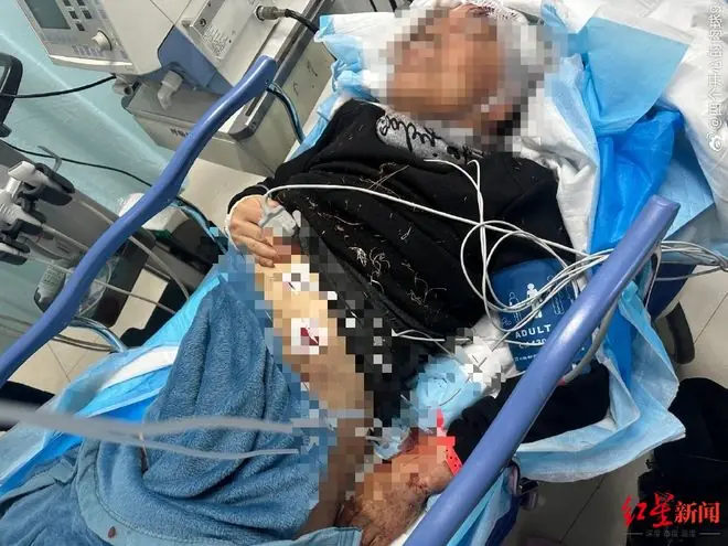 7只狗冲出笼子 六旬男子被咬成重伤缝300多针 狗主因过失致人重伤一审获刑3年