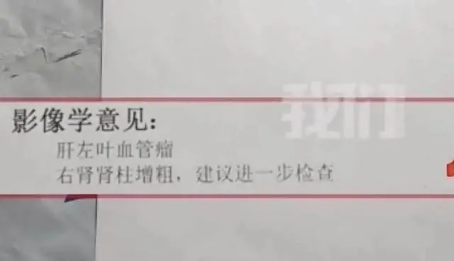山东男子时隔8年CT报告反转,“良性肿瘤”变“肝癌”,8年等不到通知,耽误的岂止是一条命